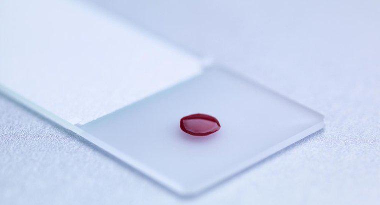 Qu'est-ce qu'un test sanguin LDH?