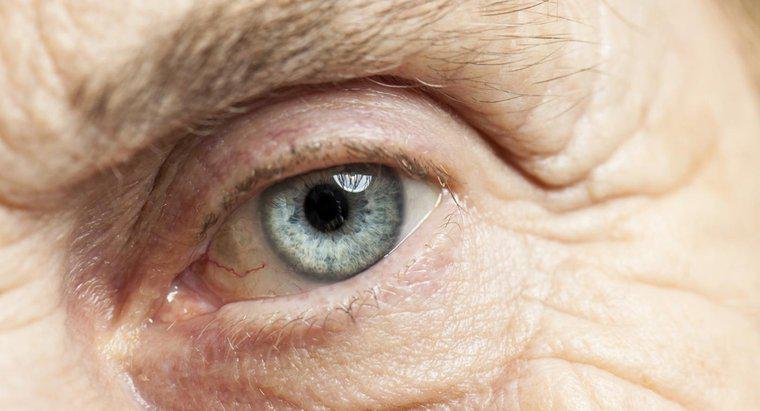 À quoi peut-on s'attendre de sa vue immédiatement après une chirurgie de la cataracte ?