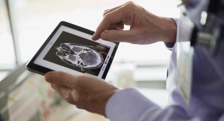 Quel est le pronostic d'un patient atteint d'une tumeur du lobe frontal ?