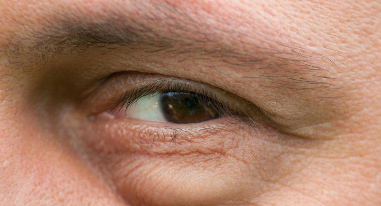 Quelles sont les causes possibles de gonflement sous les yeux?