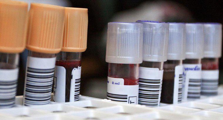 Qu'est-ce qu'un test sanguin de neutrophiles?