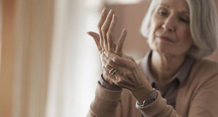 Comment guérir l'arthrite?