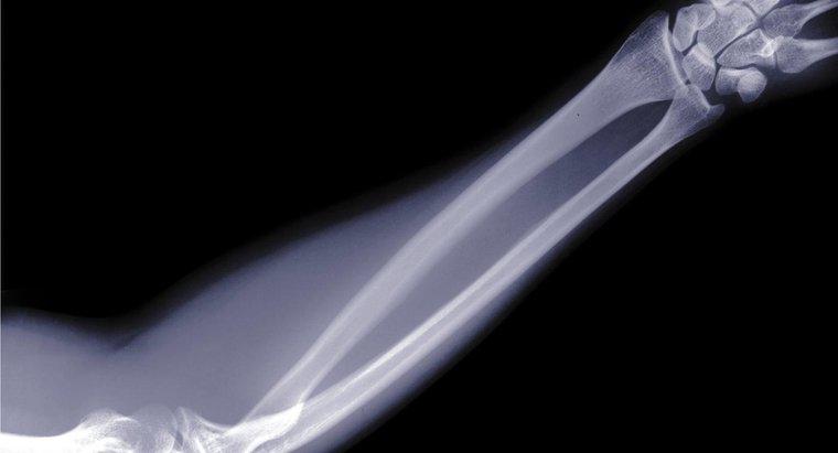 Quels sont les noms des os du bras humain ?