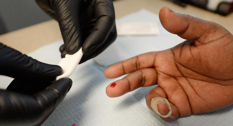 Combien de temps faut-il pour que le VIH se manifeste aux tests ?