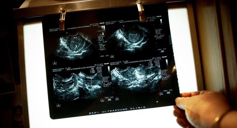 Quelle est la différence entre les ultrasons et les infrasons ?