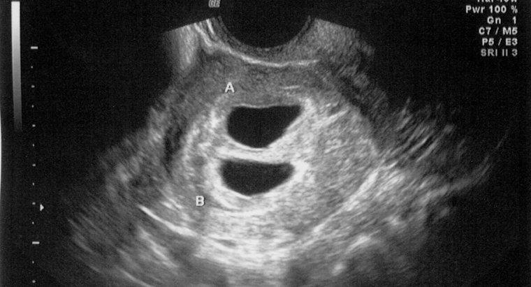 Une échographie peut-elle détecter une grossesse à 4 semaines ?