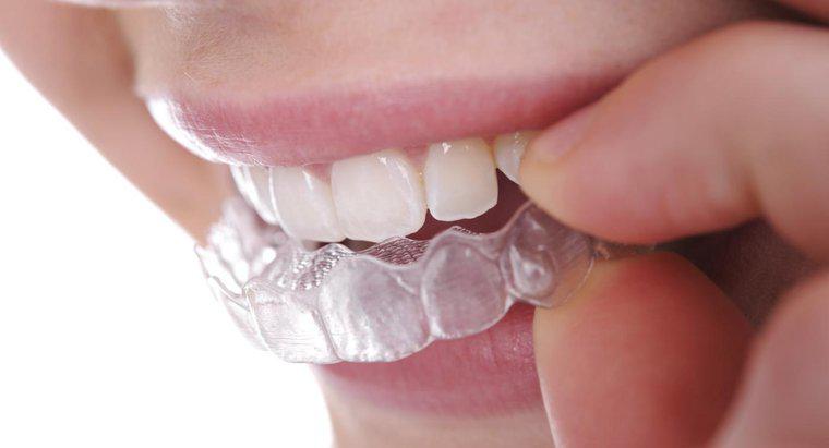 Comment redresser les dents sans appareil dentaire ?