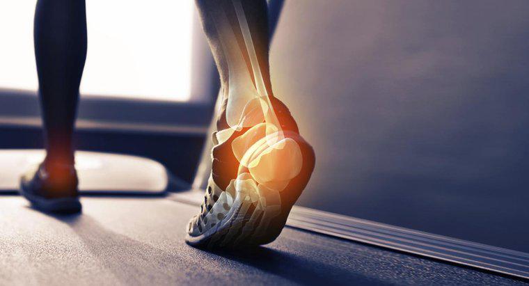 Quelles sont les causes d'un éperon osseux sur le talon de votre pied ?
