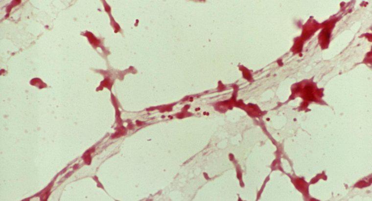 Quelles sont les causes de la méningite vertébrale?