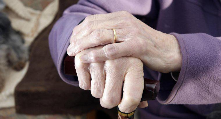 Comment diagnostique-t-on l'arthrite des mains?