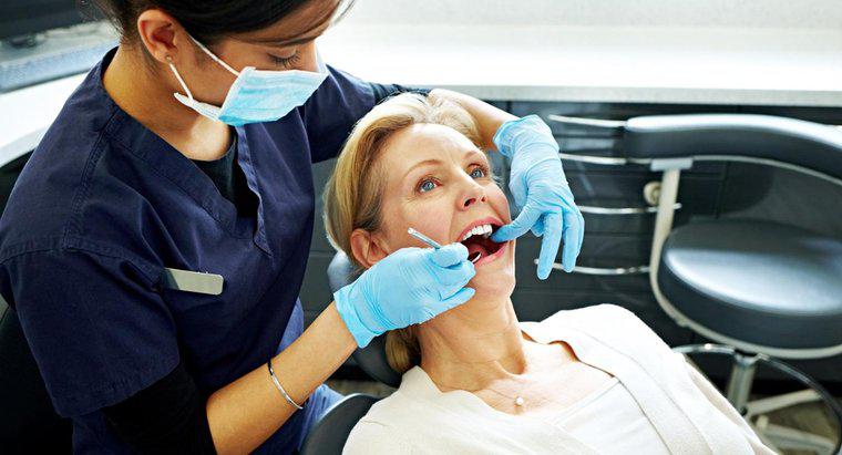 Quels sont les signes de la carie dentaire ?