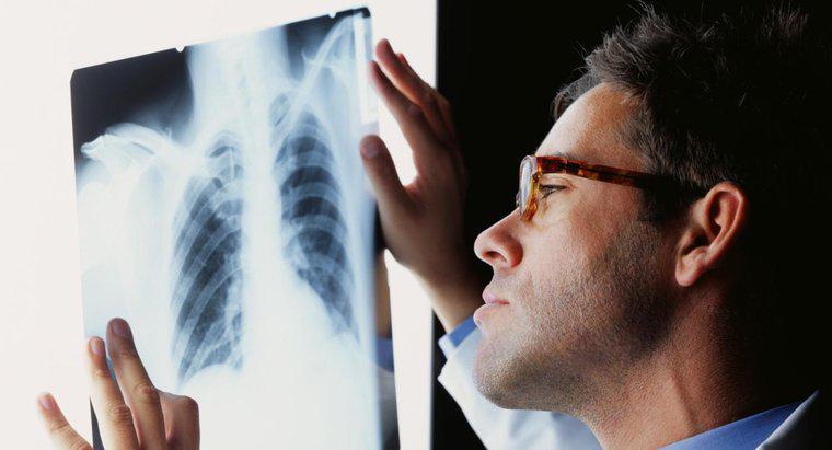 Comment traite-t-on une infection pulmonaire?