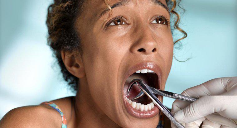 Comment traiter une infection après une extraction dentaire ?