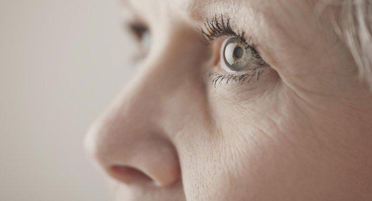 Quelles sont les principales causes des flotteurs oculaires?