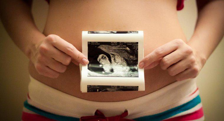 Quel est l'ordre correct des étapes du développement prénatal ?