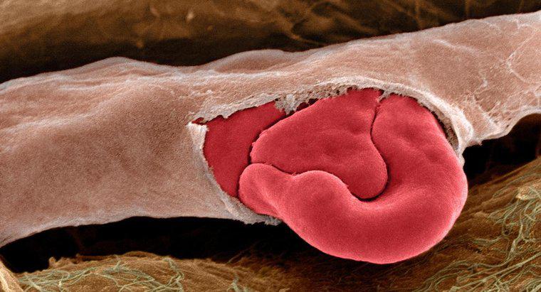Qu'est-ce qui provoque la rupture des vaisseaux sanguins ?
