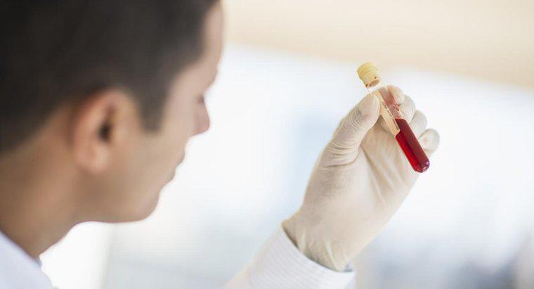 Qu'est-ce qu'un test sanguin de profil osseux?