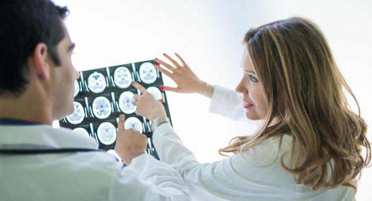 Quels sont les symptômes d'une tumeur cérébrale ?
