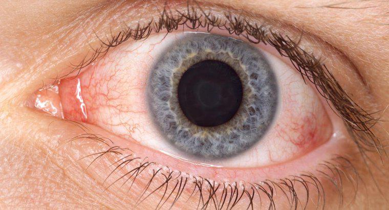 Comment l'acide borique aide-t-il à lutter contre les yeux roses?