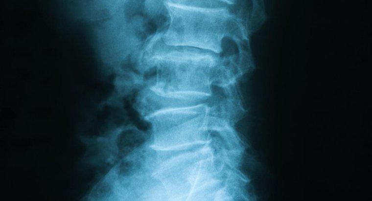 Qu'est-ce qu'une colonne vertébrale thoraco-lombaire?