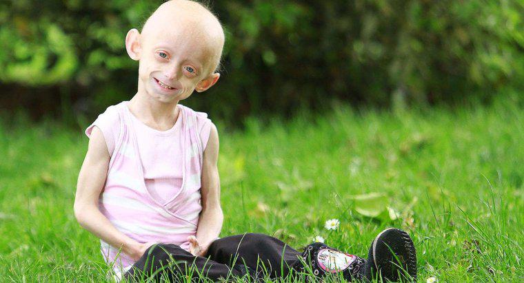 Quels sont les faits intéressants sur la progeria ?