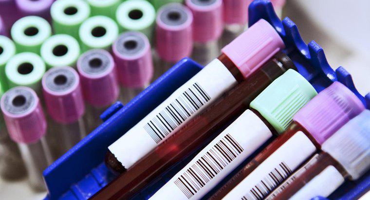 Quelles sont les abréviations courantes sur un test sanguin?