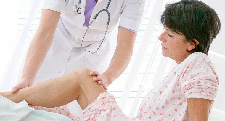 Quelles sont les causes de la douleur nerveuse dans la jambe?