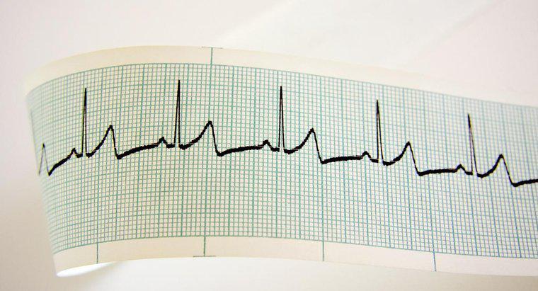 Qu'est-ce qui cause un rythme cardiaque rapide ?