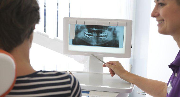 Quels sont les avantages et les inconvénients des mini implants dentaires ?