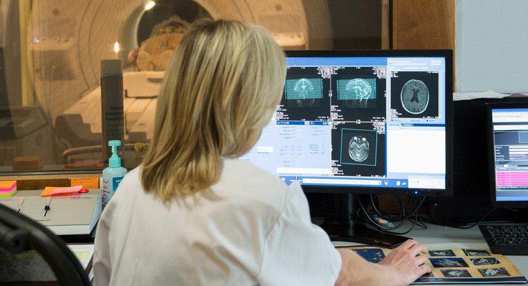 Que signifie une tache blanche sur une IRM cérébrale ?