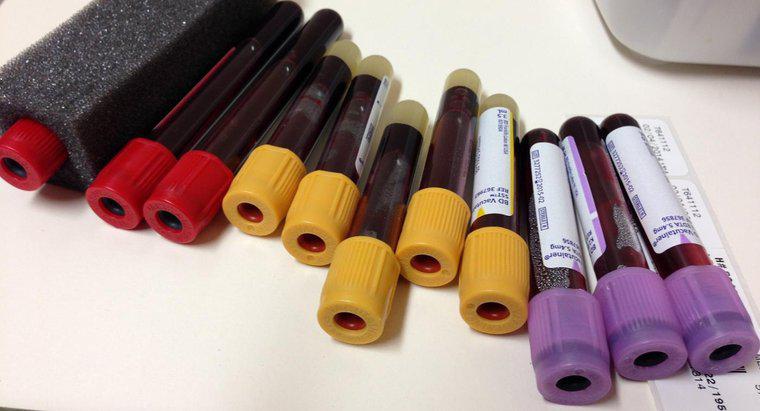 Que mesurent les niveaux de ferritine dans un test sanguin?