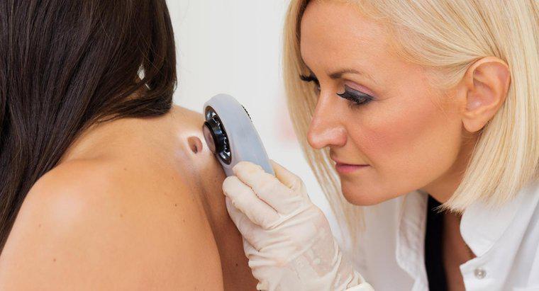 Quels sites Web médicaux montrent des images de types de cancer de la peau ?