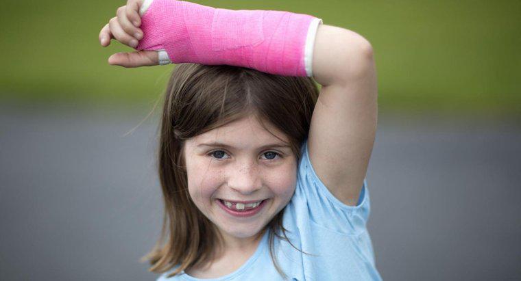 Combien de temps faut-il pour guérir une fracture du poignet ?