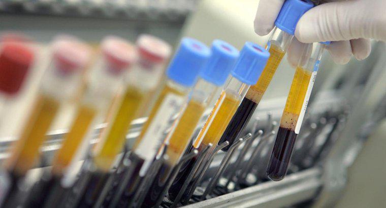 Qu'est-ce que le HCT dans un test sanguin?