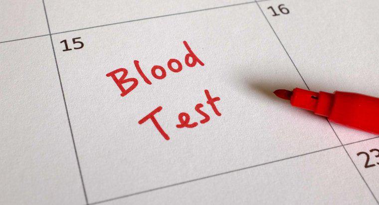 Qu'est-ce qu'un test sanguin CA 125?
