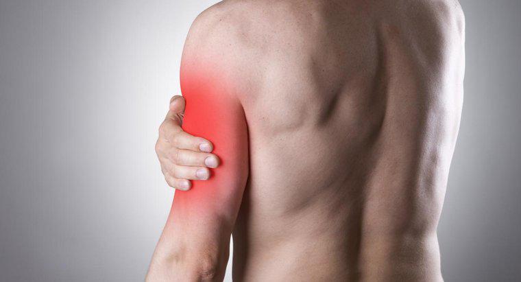 Un nerf pincé peut-il causer une douleur au bras gauche?