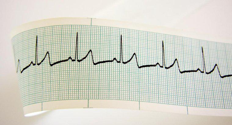 Quelle est la fréquence cardiaque moyenne pour une femme ?