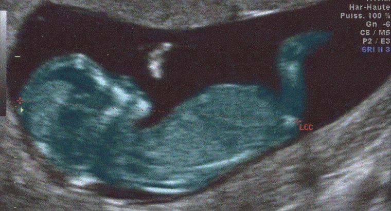 Les bébés ont-ils des branchies et des queues lorsqu'ils sont dans l'utérus ?