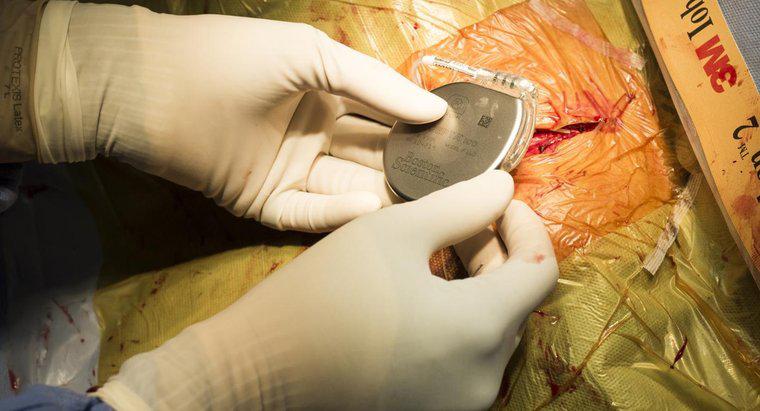 Quel est le processus de récupération pour les patients opérés d'un stimulateur cardiaque ?
