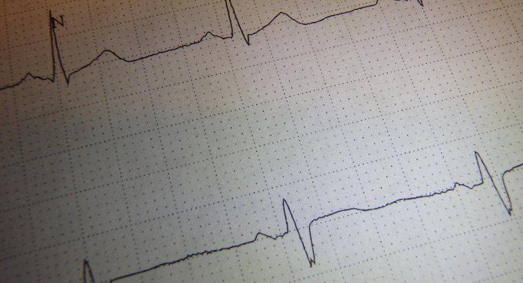 Quelle partie du cerveau contrôle la respiration et le rythme cardiaque ?