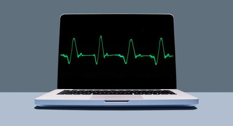 Quels sont les traitements pour le rythme cardiaque rapide ?