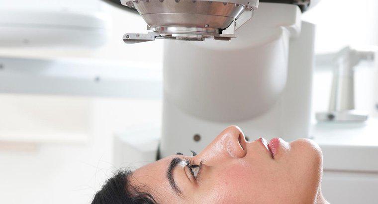 Que sont les traitements au laser pour le glaucome ?