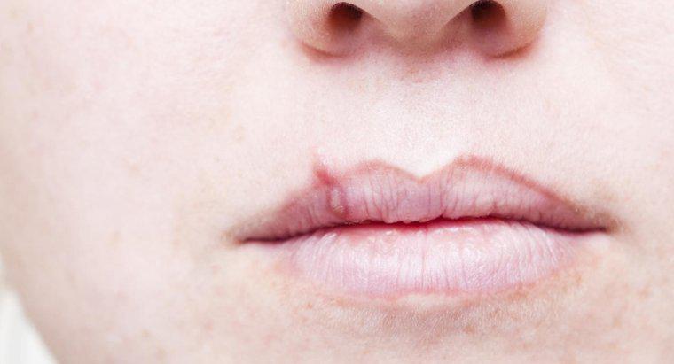 Quel est le premier signe du cancer des lèvres ?
