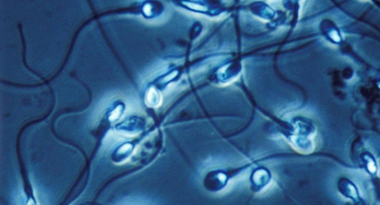 Quels sont les traitements pour la morphologie anormale des spermatozoïdes ?