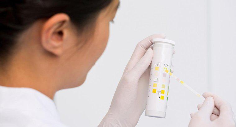 À quoi sert un test de microalbumine urinaire pour le diabète?