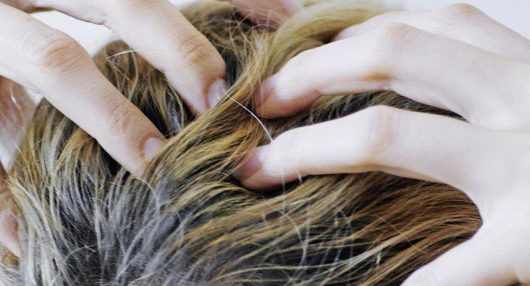 Quelles sont les causes des démangeaisons du cuir chevelu et de la perte de cheveux ?