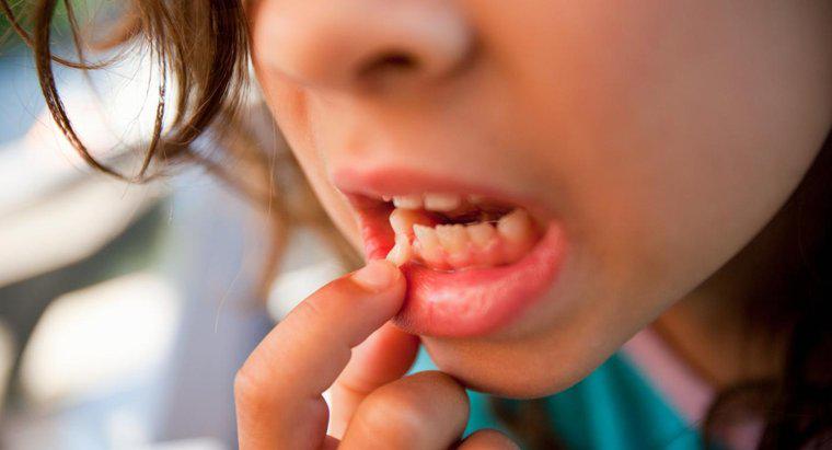 Quelles sont les causes des dents lâches chez les adultes?