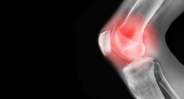 Quelles sont les causes de la douleur au genou gauche ?
