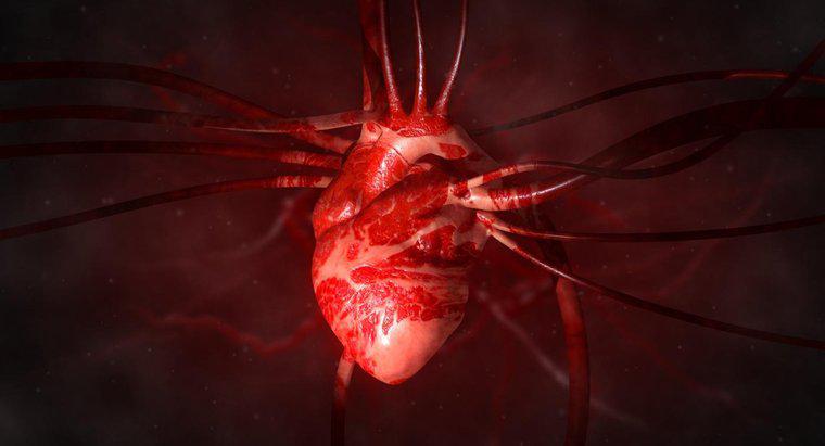 Qu'est-ce qu'une artère élargie du cœur?