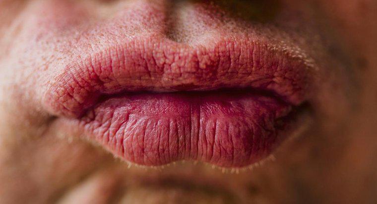 Comment traiter les lèvres gonflées à cause d'une allergie ?